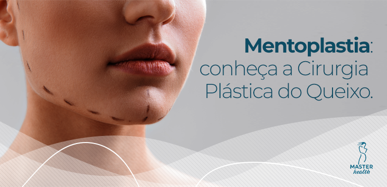 conheça a mentoplastia