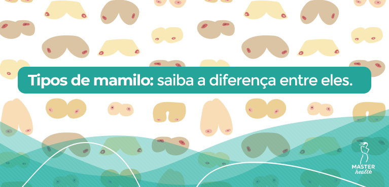 conheça os tipos de mamilos