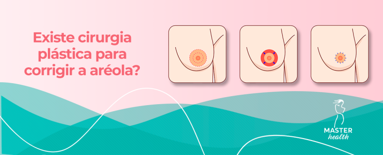 cirurgia plástica para aréola