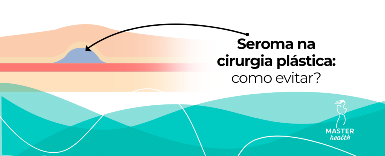 seroma na cirurgia plástica