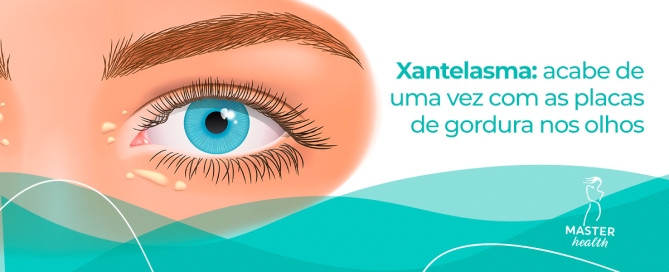 olho com bolsas de gordura logo abaixo