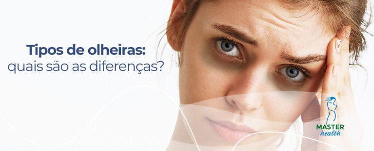 mulher com olheiras
