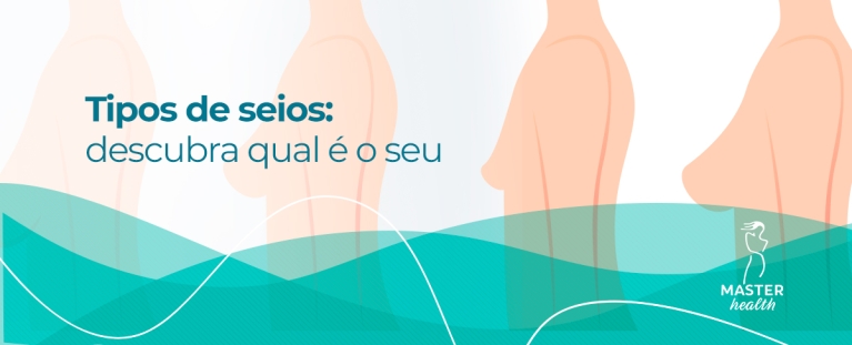 ilustração com tipos de seios