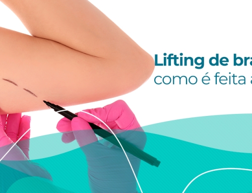 Lifting de braço: como é feita a cirurgia?