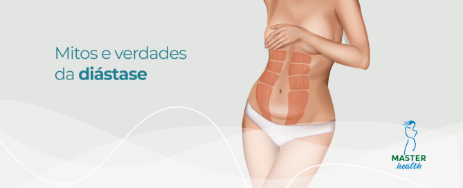 ilustração mostrando o abdomên de uma mulher com diastase