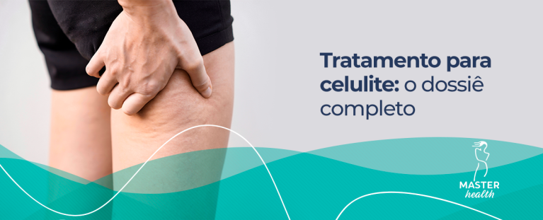 Imagem de uma pessoa usando um shorts e abertando a lateral da coxa, onde é possível ver várias celulites