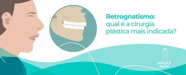 Ilustração mostrando uma arcada dentária
