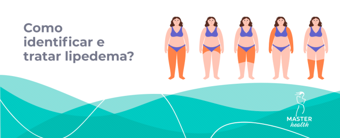 Ilustração mostrando mulheres com lipedema em diferentes partes do corpo