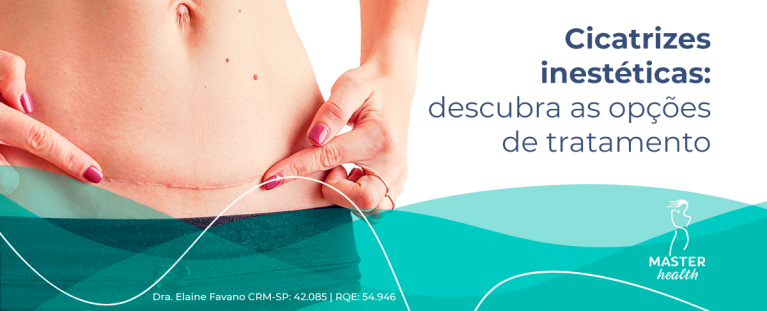 Imagem de uma barriga com os dedos apontando para uma cicatriz abaixo do umbigo