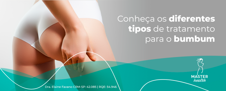 Imagem mostrando os glúteos de uma mulher, e a mesma está apertando a lateral
