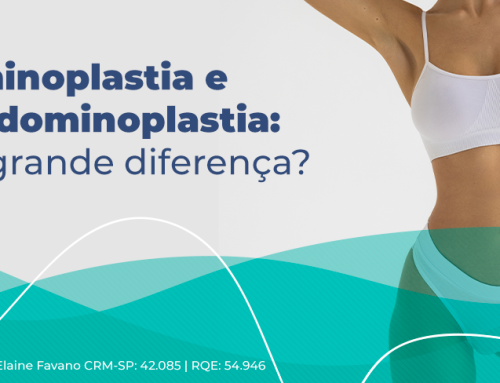 Entenda a diferença entre abdominoplastia e miniabdominoplastia