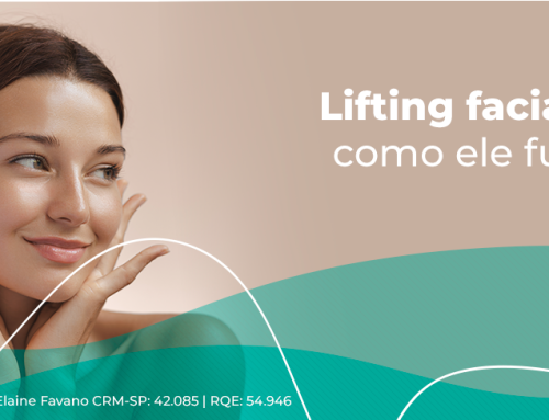 SMAS: como ele pode levantar seu rosto?