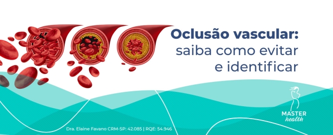 Ilustração mostrando os vasos sanguíneos