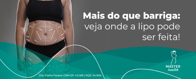 Imagem mostrando o tronco de uma mulher, com várias marcações pontilhadas em branco