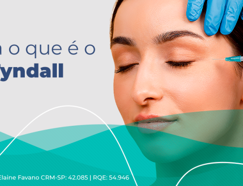 Efeito Tyndall: cuidados essenciais na hora do preenchimento