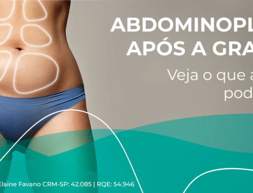 Abdominoplastia após a gravidez: quando ela é indicada e por que pode ser importante