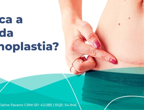 Cicatriz da abdominoplastia: como fica e como cuidar