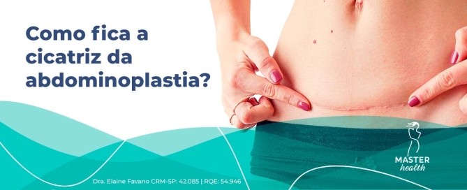 cicatriz abdominoplastia como fica