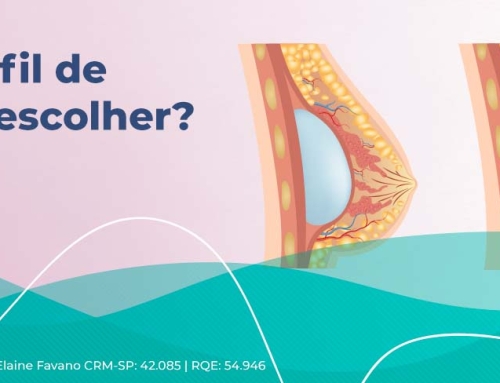 Perfil de prótese de silicone: alto, médio ou baixo – qual escolher?
