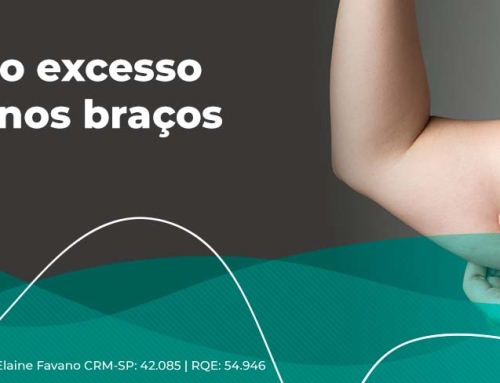 Flacidez nos braços: quando a braquioplastia é indicada?
