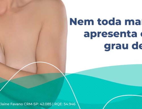 Ptose mamária: como identificar os diferentes graus de flacidez das mamas?